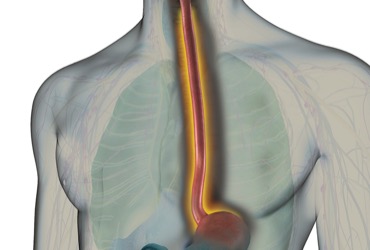 Diagnosis of Esophageal Motor Disorders