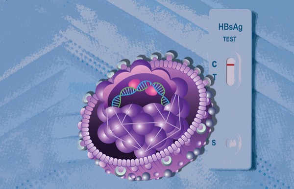 Bepirovirsen Reduces HBV Proteins In Phase 2B Trial