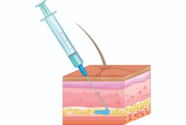 Moving From IV to Subcutaneous Infliximab, and an Updated Look at ...