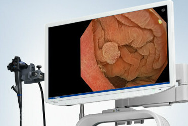 New Olympus Endoscopy System Set to Debut Late Fall