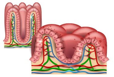 TTG-IgA Shows Potential as Noninvasive Predictor of Celiac Disease in ...